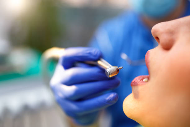 Dental Inlays and Onlays in Fort Washington, PA